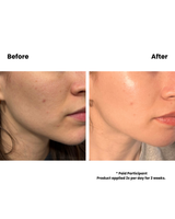 Essential Face Moisturizer